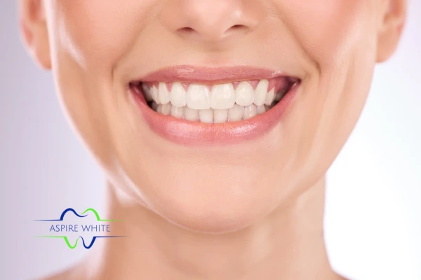 Follow your teeth whitening aftercare Sutton to prolong your whiter smile!