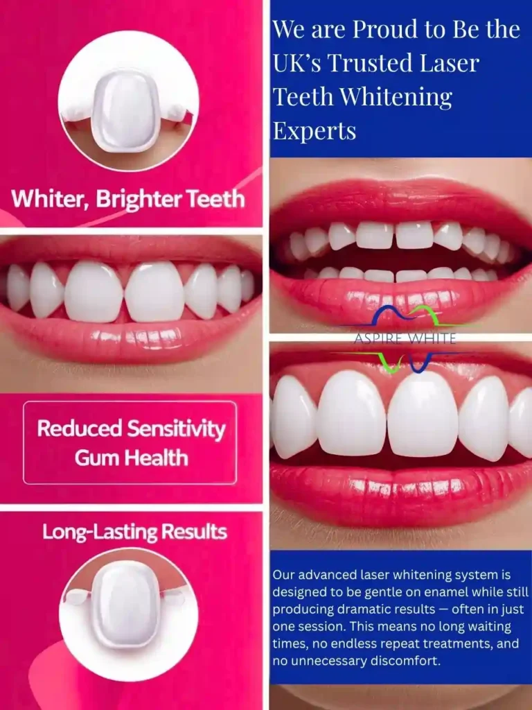 We are Proud to Be the UK’s Trusted Laser Teeth Whitening Experts Sutton